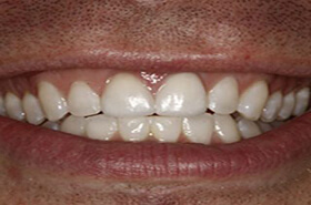 After image