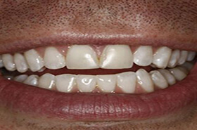 Before image